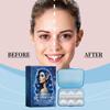 Cosmetology Ear Correction Paste Ear Paste Easy Shape To Enhance The Charm Of Waterproof Anti-sweat Ear Paste