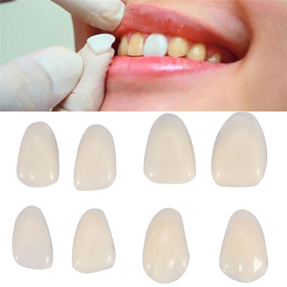 New 100Pcs Dental Temporary Crown Veneers for Anterior Front Teeth Whitening