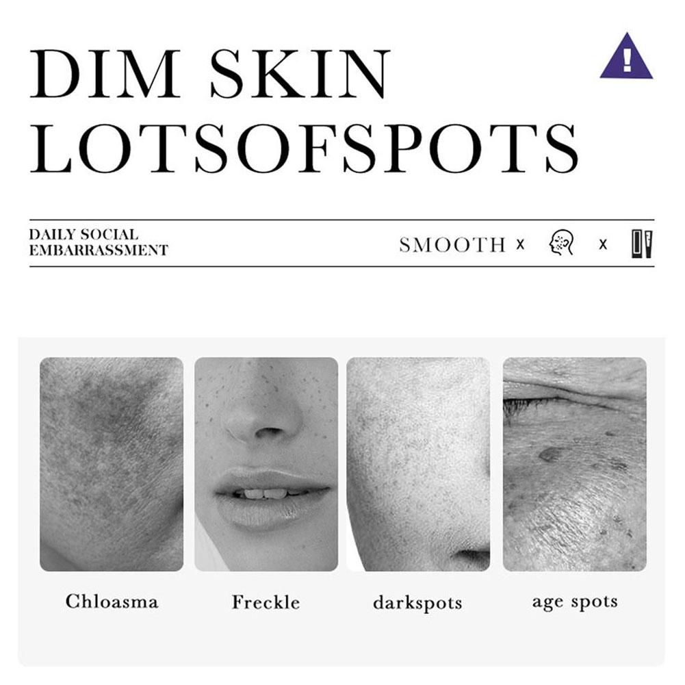 20g Powerful Yunnan Herb Whitening Freckle Cream Remove Face Moisturizing Care Face Dark Spots W8V5