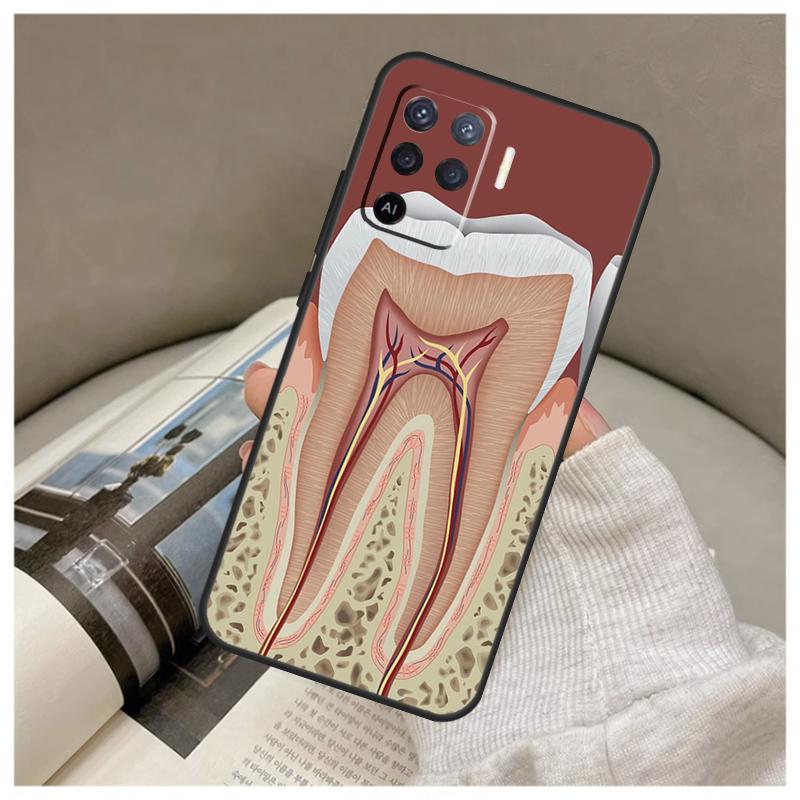 Чехол с анатомией зуба человека для Oppo A74 A94 A54 A18 A38 A58 A78 A98 A80 A60 A40 A96 A76 A16 A15 A17 A57 A77 A5 Pro