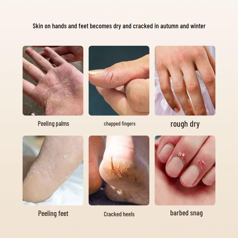 Крем для рук и ног Zhisenmeiye 50 г с лошадиным жиром для сухой, потрескавшейся кожи - Увлажняющая, против обветривания и мороза формула