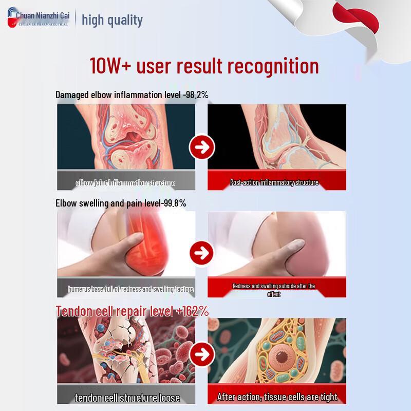 Мазь Чуань Нянь от теннисного локтя и боли в суставах