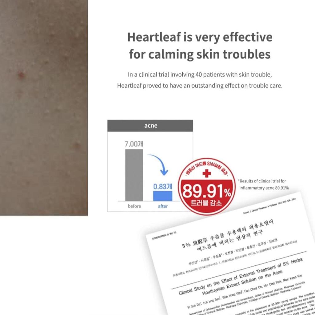 Anua Heartleaf 77% Успокаивающий тоник 500 мл + крем Acnon для удаления прыщей 13г