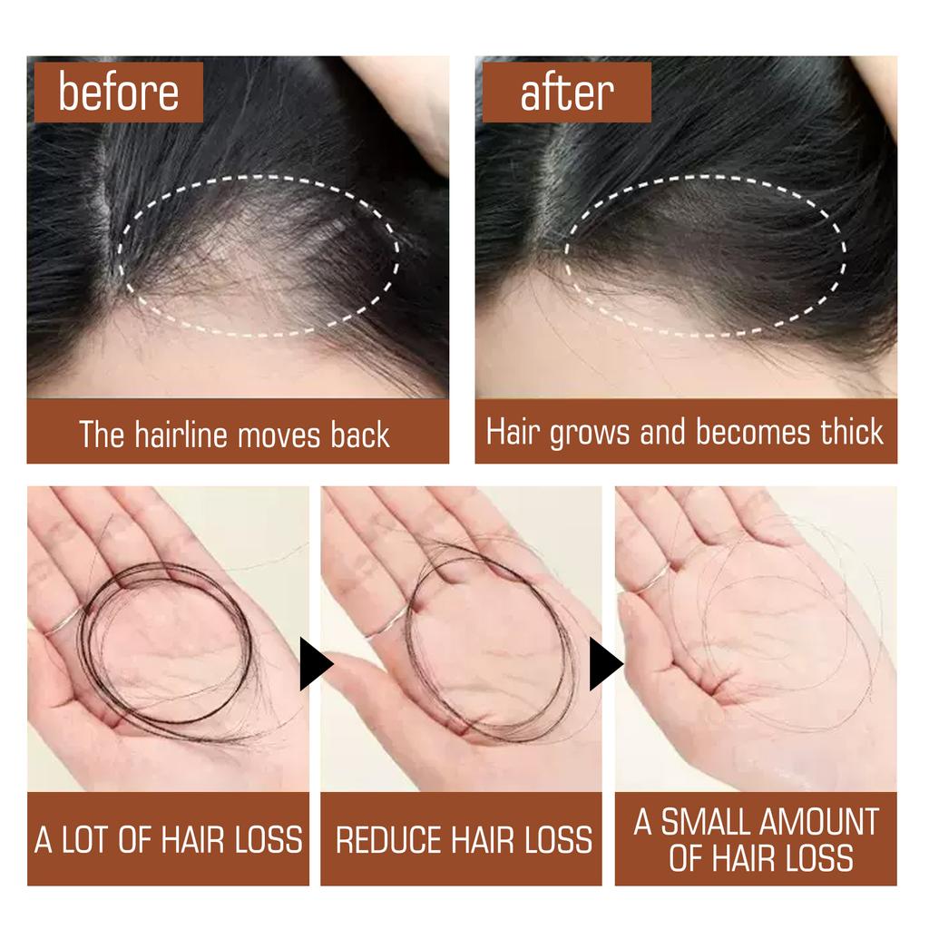 100% Pure Organic Batana Oil Hair Mask Growth Treatment Nourish Reduce Hair Loss Anti-Breakage