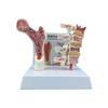 Osteoporosis Spine Model Human Anatomy Osteoporosis Model Medicals Learning Tool for Anatomy Education Constructed