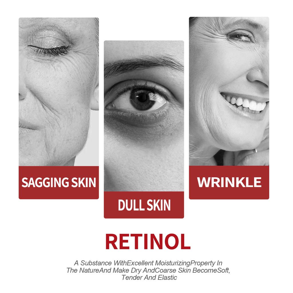 Retinol Moisturizing Cream Fades Fine lines Dark Circles Moisturizing Tightening Pore Anti-aging Cream