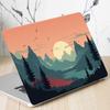 A+C Side 15inch Laptop Stickers Skins Ultrabook Decorate Decal for Macbook/HP/Dell/Lenovo Universal