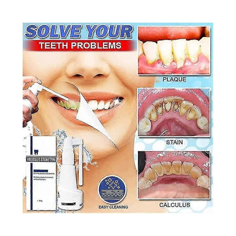 Calculusfree Dissolving Dental Spray, Dental Calculus Remover Teeth Cleaner, Mouth Refreshing Spray