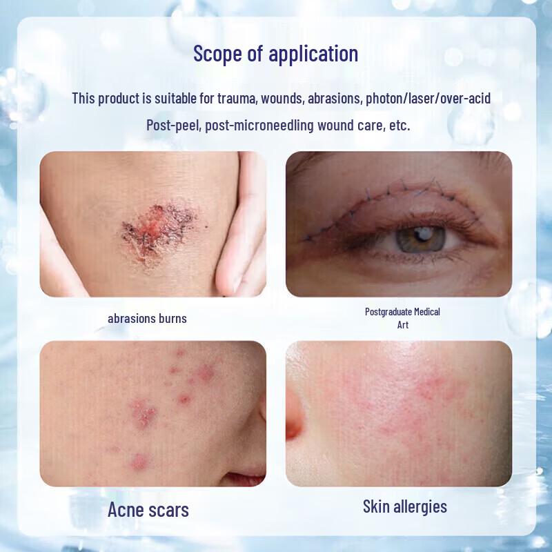 Гель для восстановления рубцов с фактором роста человека Kangruibao