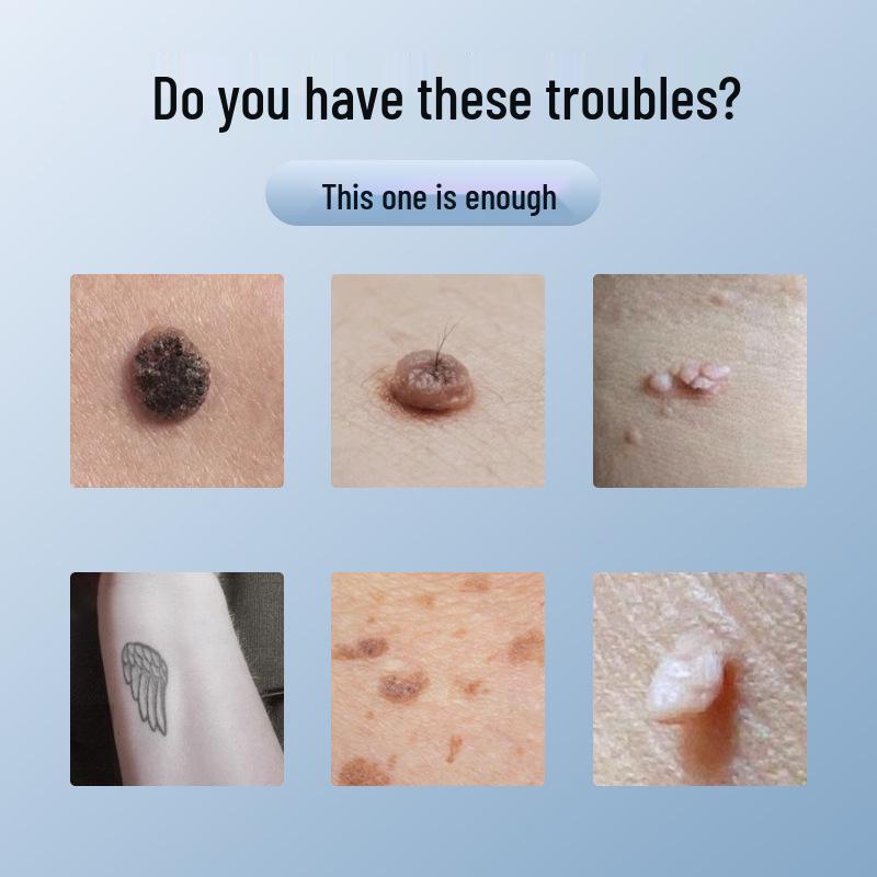 Ультрапикосекундный лазер для удаления веснушек и родинок: Портативный «Всё в одном» для домашнего и салонного использования