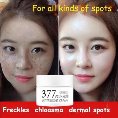 377 отбеливающий крем VC крем веснушки хлоазма старческие бляшки салоны красоты крем для контроля желтизны