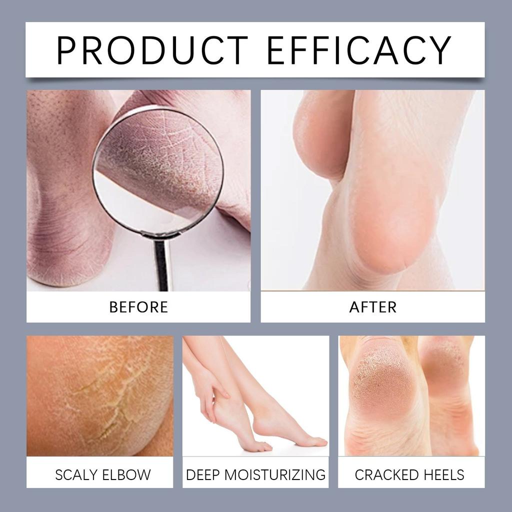Питательный крем для ног Увлажняющий и увлажняющий крем для ног от сухости и питания