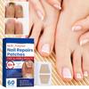 Hands And Feet Soft Nail Inlaid Nail Thickening Bright Nail Furrow Gray Nail Care Patch