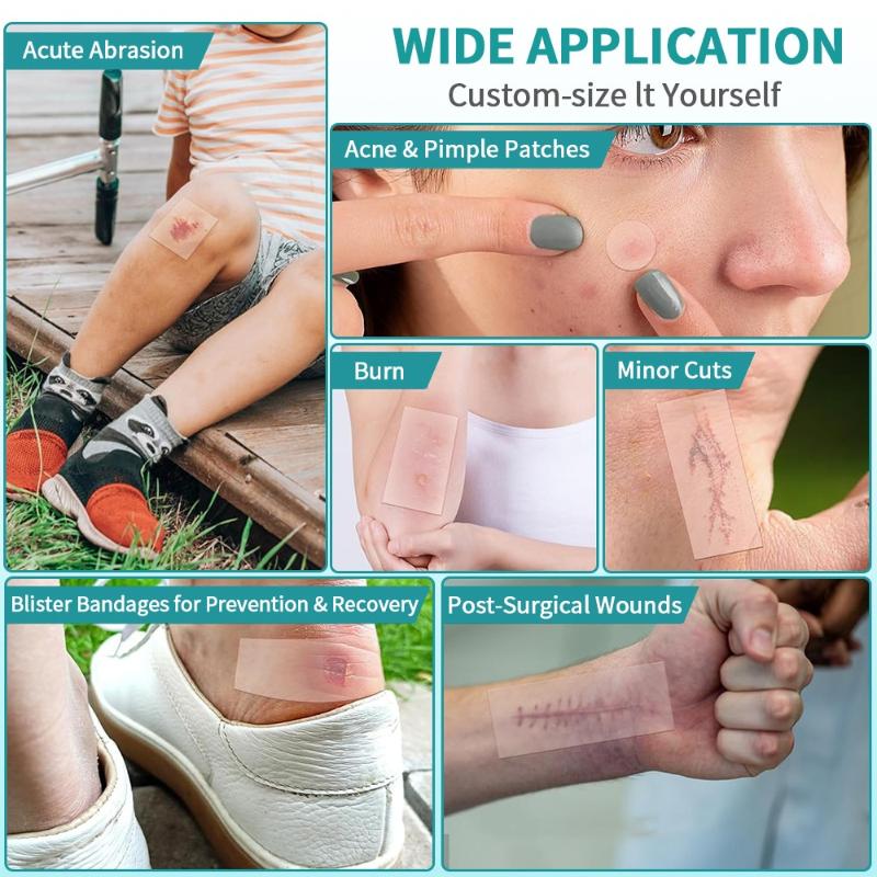 Гидроколлоидные рулонные повязки – Самоклеящиеся, Высокоабсорбирующие пластыри для ухода за ранами при ожогах и пролежнях