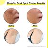 Masofta Dark Spot Reduction Cream for Pigmentation For Men & Women 50gm