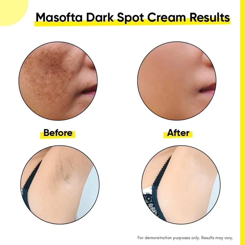 Masofta Dark Spot Reduction Cream for Pigmentation For Men & Women 50gm