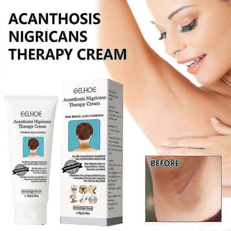 3pcs Acanthosis Cream Nigrifix Cream For Acanthosis Nigricans Black Spot