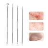4Pcs Stainless Steel Acne Blackhead Removal Needle Tool Kit Deep Facial Clean