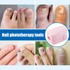 Светодиодное устройство для лечения грибка ногтей 460 нм синий свет USB зарядка очиститель онихомикоза для восстановления здоровья ногтей и облегчения боли терапия ногтей синим светом