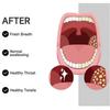 Tonsil Stone Remover Kit - Electric Vacuum & Water Flosser for Tonsil Stones Removal - Oral Care Tool