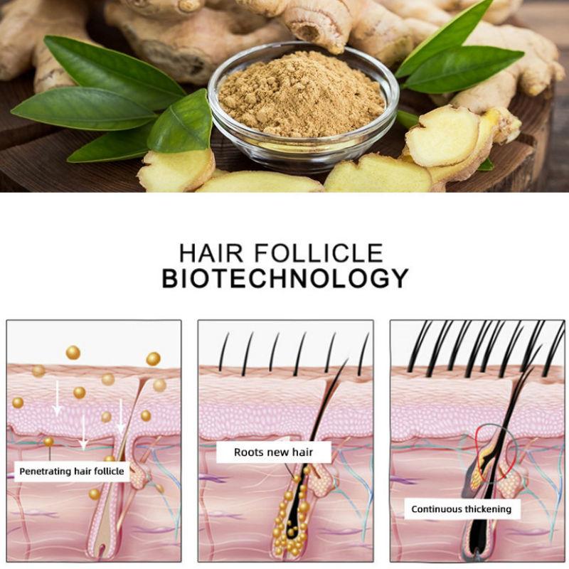 Масло для роста бороды Эссенция для усов Уход за усами Стайлинг Жидкость для волос Пилинг Имбирное масло