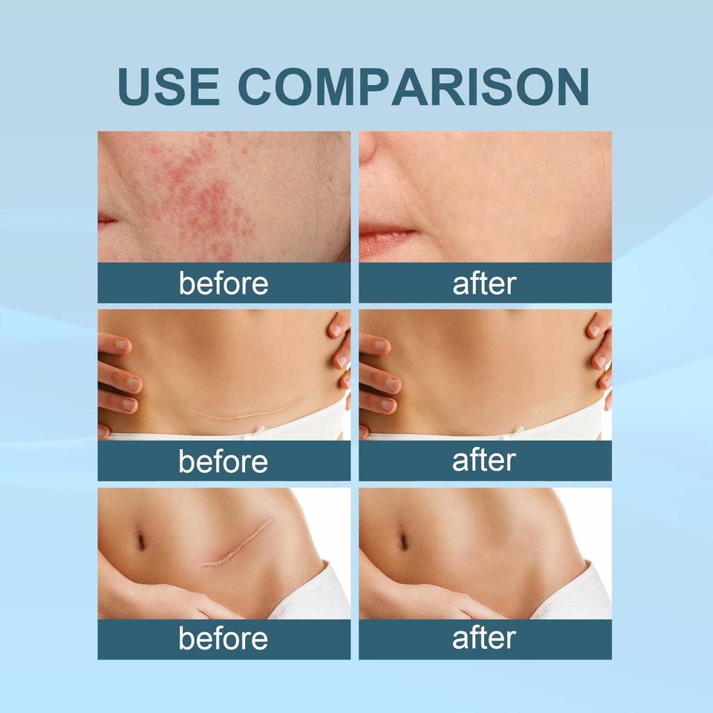 20 г West&Month Гель для восстановления рубцов Осветляющий Увлажняющий Восстанавливающий кожу Разглаживающий кожу Гель