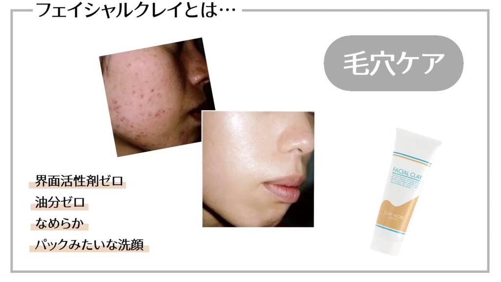 Из Claymore Kate Facial Clay Facial Wash Clay Face Wash x 2 Clay Clay Face Wash Foam [Набор 2] (Бутылки 280 г)