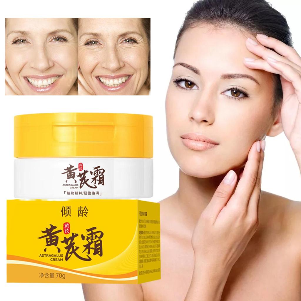 Chinese Astragalus Whitening Freckles Cream Remove Anti-aging Moisturizing Lightening Care Brig N8F7