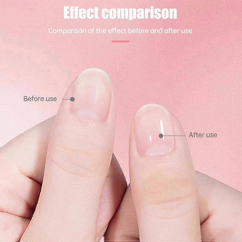 Cosmetics Nail Growth Oil, Rejuvenation Nail Growth Oil,Cosmetics Nail Growth Oil Rejuvenation