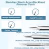 Набор инструментов для удаления черных точек из нержавеющей стали, средство для удаления черных точек класса Blackhead Extraction Blackhead / Whiteheads / MI2 / Pimples Remover For Face