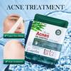 Tea Tree Mask 25g SADOER Refreshing Moisturizing Moisturizing Tablets