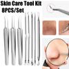 Stainless Steel Makeup Tool Pimple Removing Face Care Tool Blackhead Removing Skin Care Tool Kit
