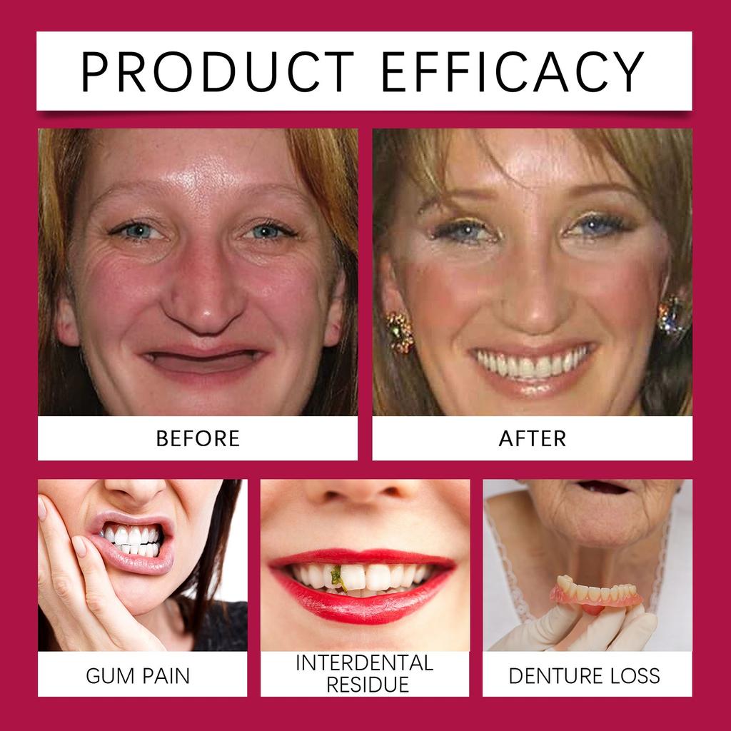 Термопластичный клей для зубных протезов, термопластичный клей для зубных протезов, термопластичный клей для зубных протезов, безопасный клей для зубных протезов