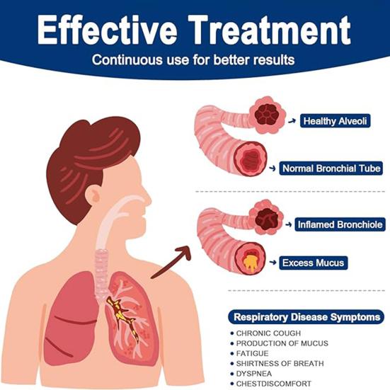 Устройство для тренировки легких, клапан, инструмент для удаления слизи, многоразовое компактное портативное устройство для удаления слизи, устройство для расширения легких