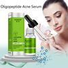 Oligopeptide Acne Clearing Serum Treatment Cream Pore Repair Anti Aging Moisturizing Essence