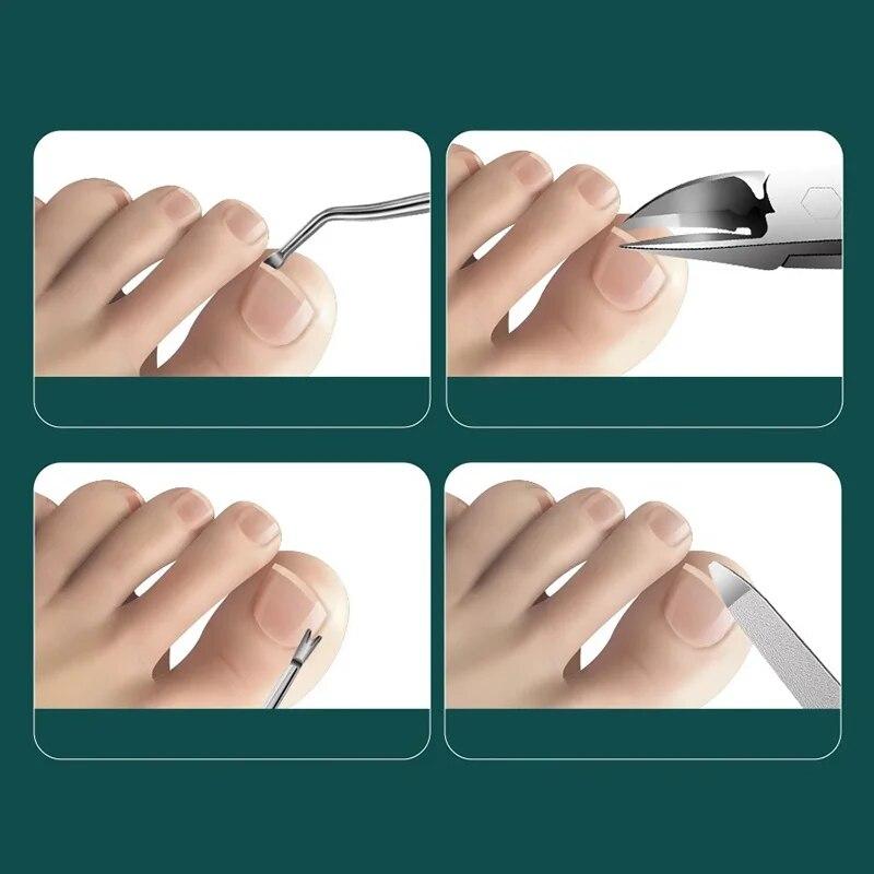 Кусачки для ногтей из нержавеющей стали, кусачки для пальцев, плоскогубцы для омертвевшей кожи, плоскогубцы для орлиного носа, профессиональные инструменты для ремонта ногтей, маникюрный набор