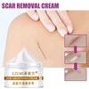 5 г/15 г/30 г/50 г/крем для восстановления шрамов для осветления шрамов, крем для восстановления шрамов при хирургии беременности, разглаживающий крем для ухода за кожей