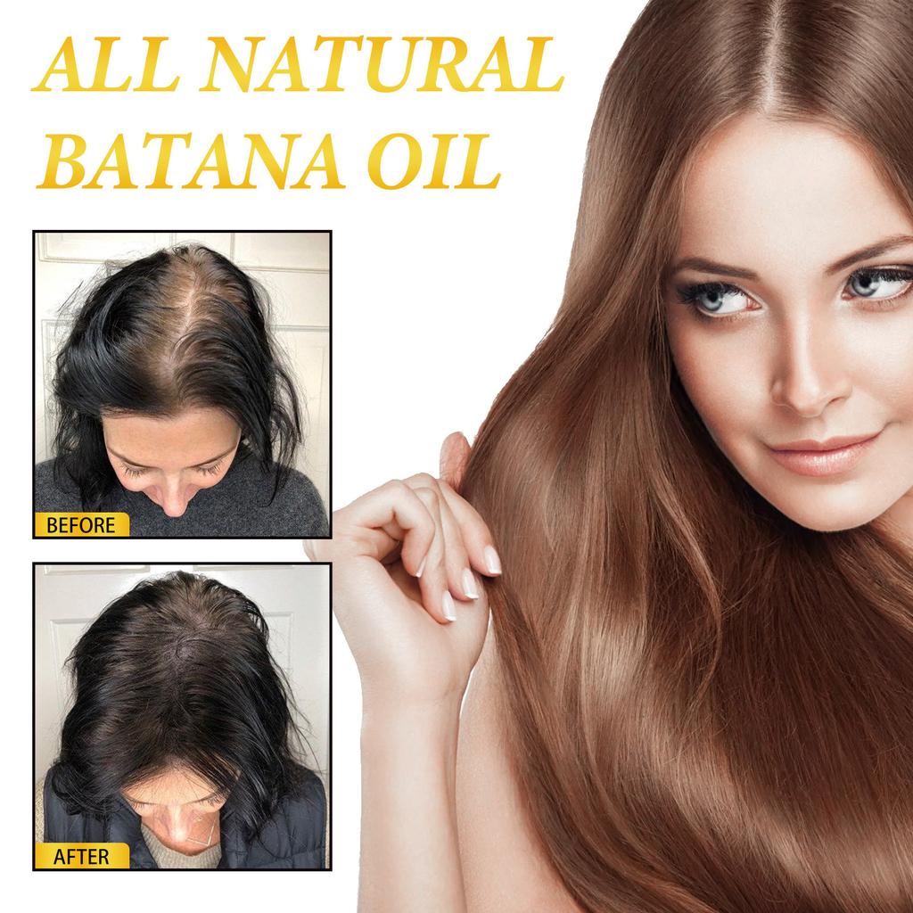 Batana Oil Hair Mask Repairs Dry and Frizzy Hair, Nourishes, Softens, and Thickens Hair