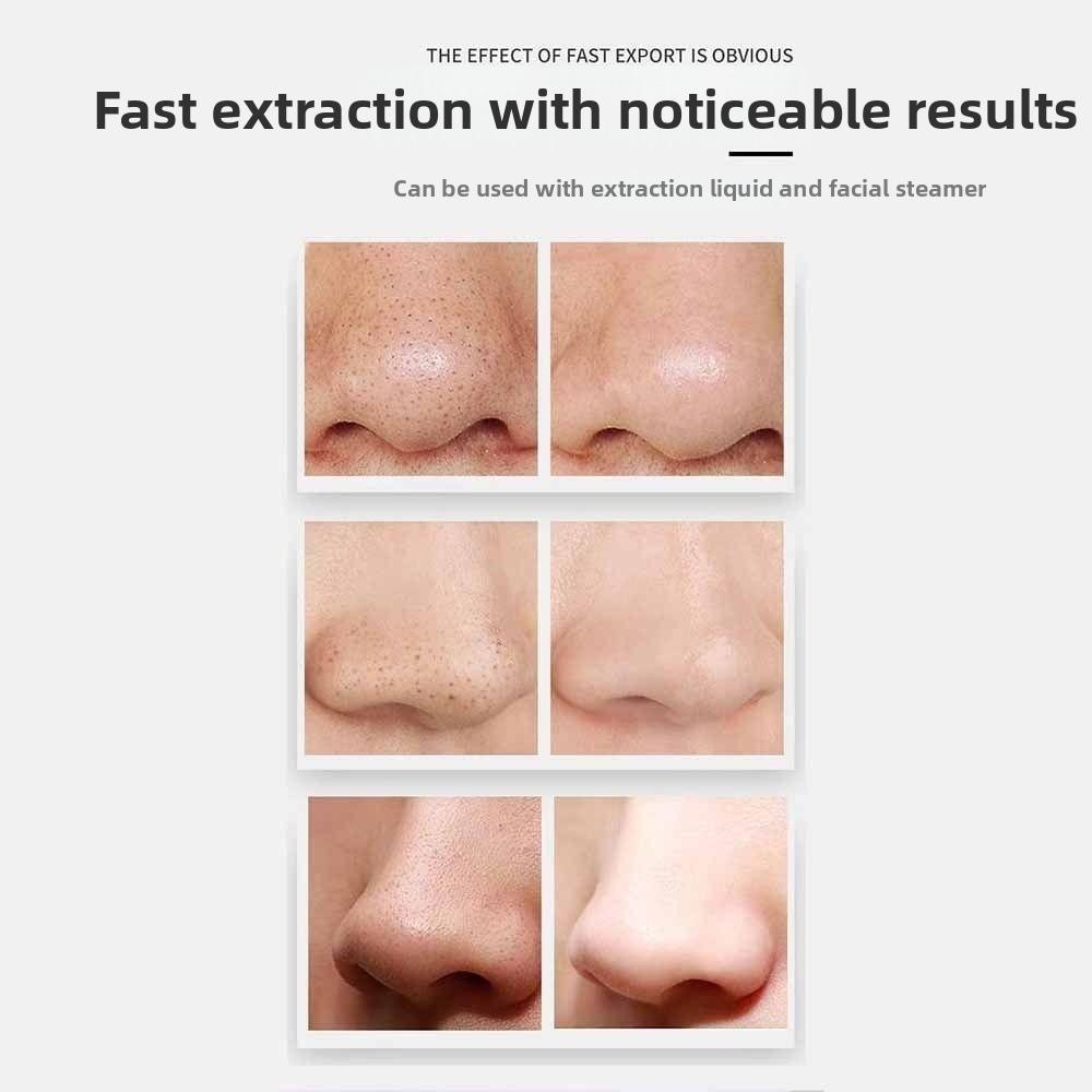 Non Damaging Pores Blackhead Remover Adjustable Power Beauty Device  Personal Care