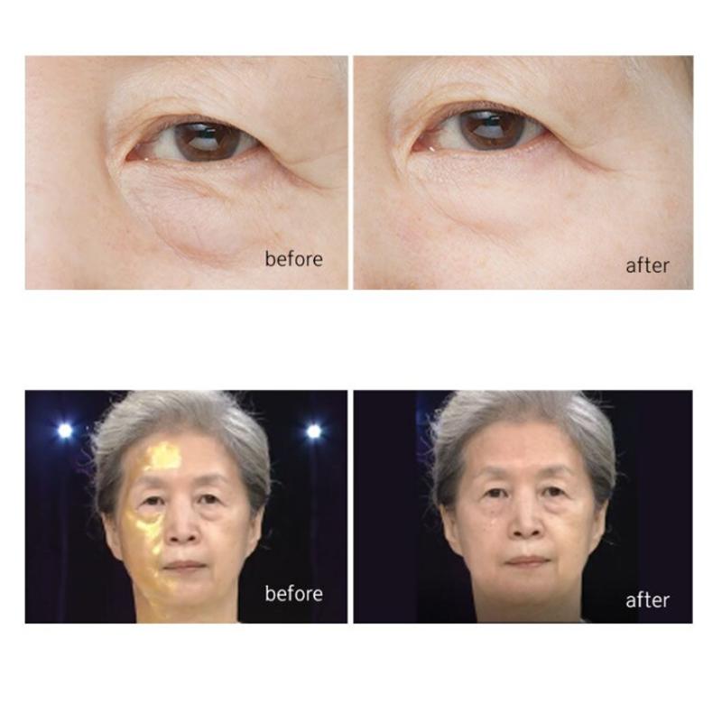 CLEDBEL Power Lift Program One Kill V Lifting Mask 70ml Black (3 Options)