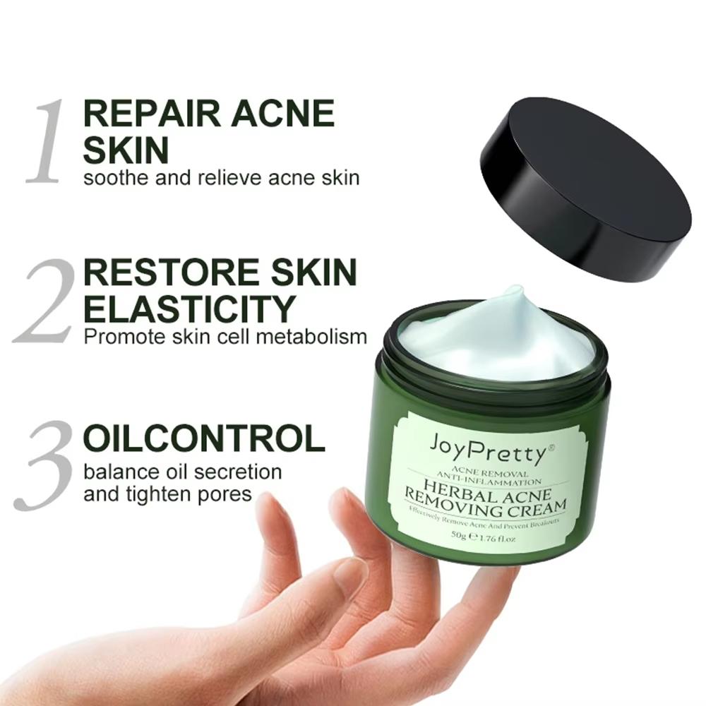 JoyPretty Herbal Acne Face Cream Body Pimple Treatment Oil Control Увлажняющие кремы для лица Средства по уходу за кожей Красота
