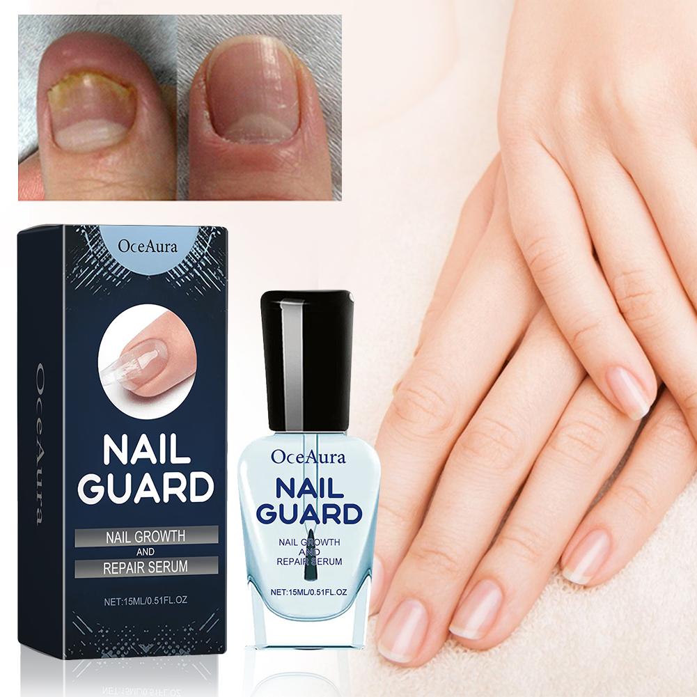 15 мл сыворотка для укрепления ногтей жидкость для восстановления ногтей для восстановления и укрепления ногтей