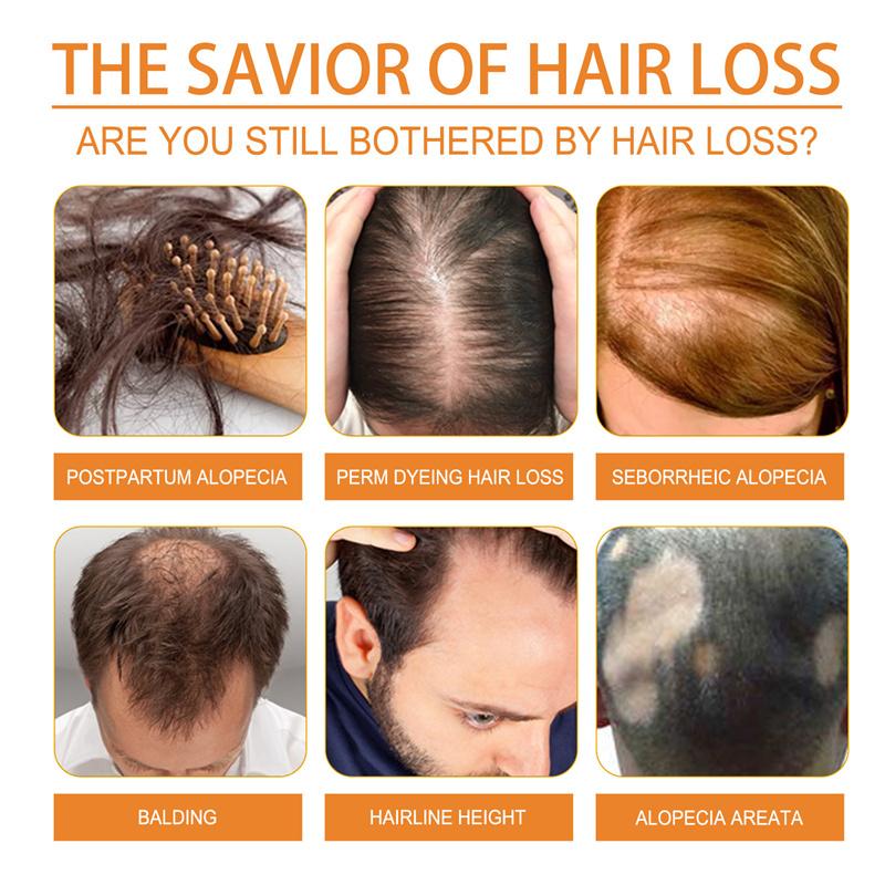 Pumpkin Seed Oil Moisturizes and Repair Hair Root Dense Hair Solid Hair Supple and Strong Hair Care Essential Oil