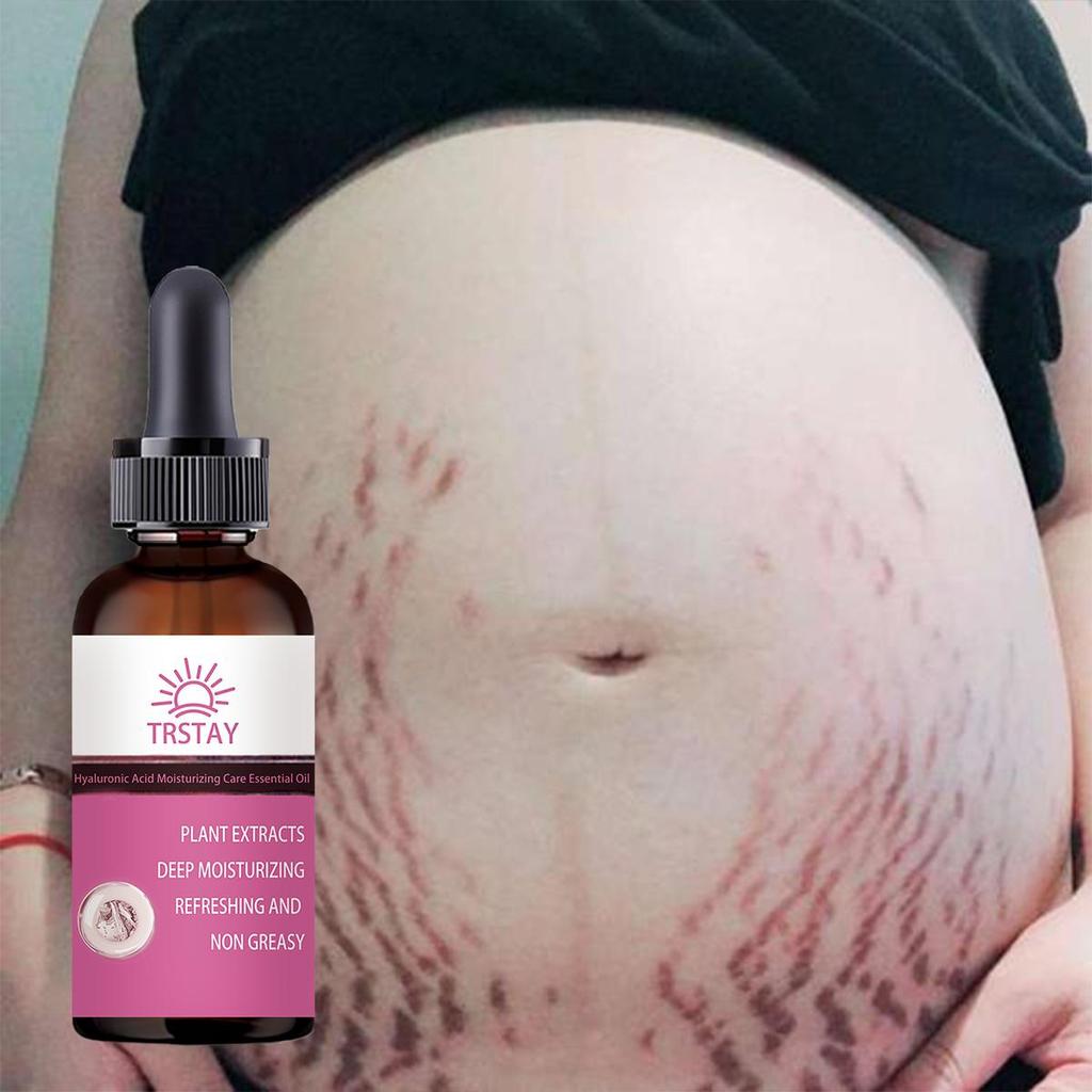 Pregnant Women Repair Belly Lines, Postpartum Repair Cream, Prevention Body Cream, Moisturize Skin , Remove Pregnancy Lines, Fat Lines, Face Cream