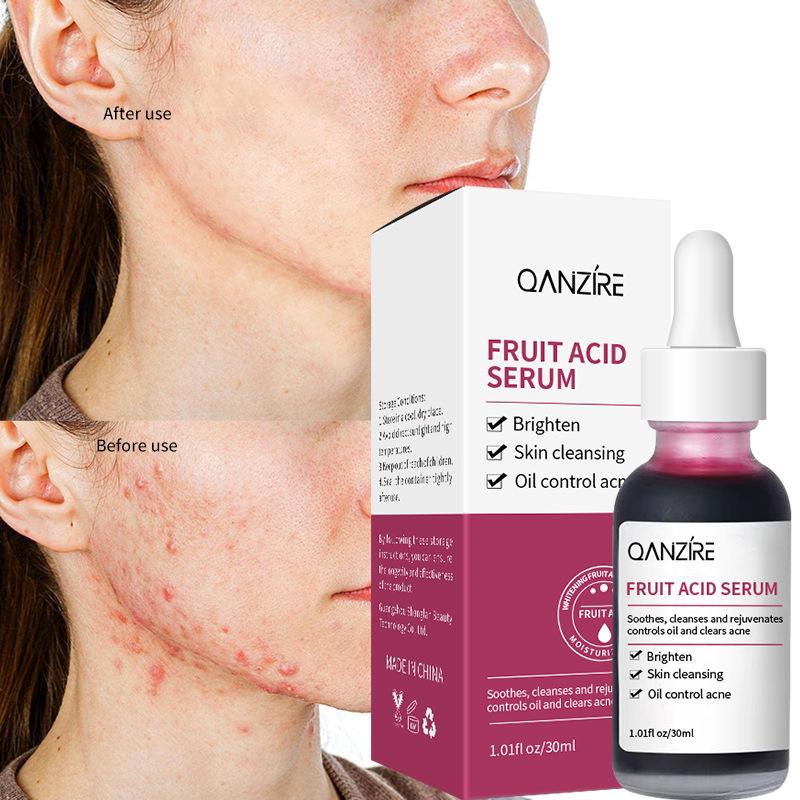 Fruit Acid Essence Fine Pore Cleansing Skin Brightening Skin Skin Softening Corneous Skin Care Product Liquid