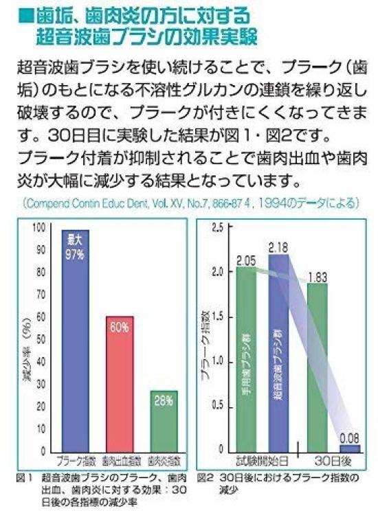 Ультразвуковая электрическая зубная щетка 1,6 МГц AU-300D