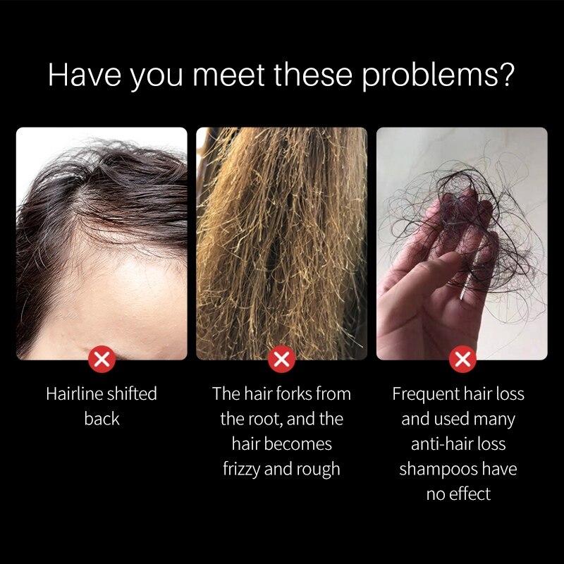 50ml Black Rice Water Hair Spray Hair Growth Essence Anti Hair Loss Natural Thinning Anti Hair Loss Soothe Itchy Dry Scalp Care