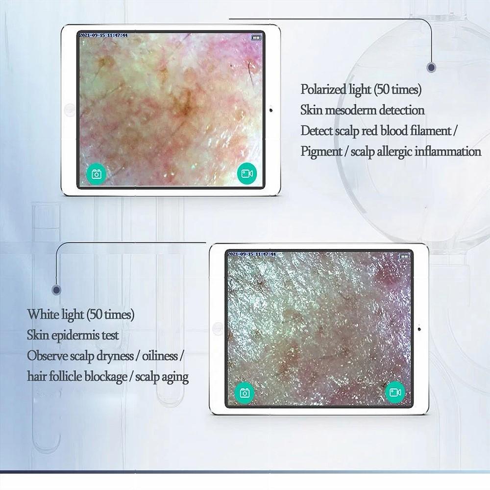 Skin Hair Analyzer,50x/200x Lens WiFi 5g 1000w Pixels,Hair Analysis Analyzer, Scalp Hair Detector, Scalp Moisture Tester,for Home Spa Salon Use