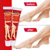 1/3/5pcs Sumifun Hot Varicose Veins Treatment Cream 100% Original Vasculitis Phlebitis Spider Pain Relief Ointment Medical Plaster