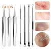 Blackhead Remover Tweezers Set Stainless Steel Acne Clip Kit with Anti-slip Handle Pimple Popper Tool Easy To Carry Blackhead Extractor Skin Care